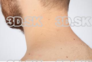 Neck texture of Charlie 0003